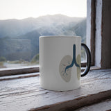 Beyond the Visible Morphing Mug - Lungs with PAVM