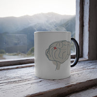 Beyond the Visible Morphing Mug - Brain with AVM