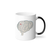 Beyond the Visible Morphing Mug - Brain with AVM