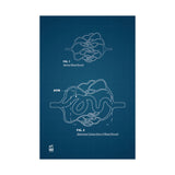 Blueprint for a Cure - AVMs | Medical Anatomy Matte Vertical Posters, Educational Artwork, Wall Decor for Science Lovers, Unique Gift for Students, Science Poster, [...]