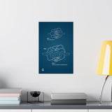 Blueprint for a Cure - AVMs | Medical Anatomy Matte Vertical Posters, Educational Artwork, Wall Decor for Science Lovers, Unique Gift for Students, Science Poster, [...]