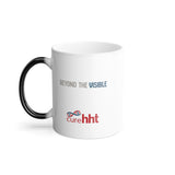 Beyond the Visible Morphing Mug - Brain with AVM