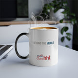 Beyond the Visible Morphing Mug - Brain with AVM