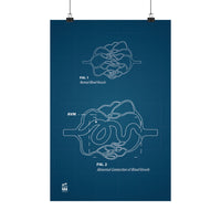 Blueprint for a Cure - AVMs | Medical Anatomy Matte Vertical Posters, Educational Artwork, Wall Decor for Science Lovers, Unique Gift for Students, Science Poster, [...]