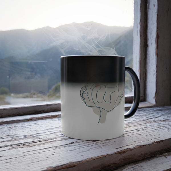 Beyond the Visible Morphing Mug - Brain with AVM
